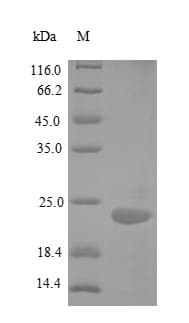 Human TNFRSF25 / DR3 Protein (Recombinant 6His, N-terminus)
