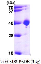 Human LDHB / Lactate Dehydrogenase B Protein (Recombinant His)