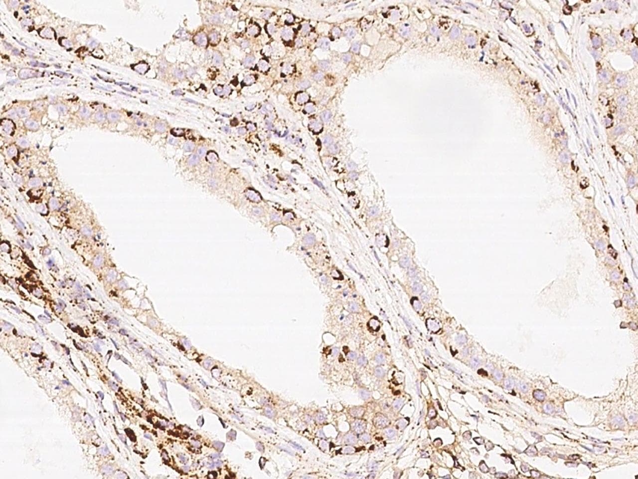 C14orf104 Antibody