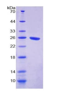 Rat SIRPA / CD172a Protein (Recombinant His-T7)