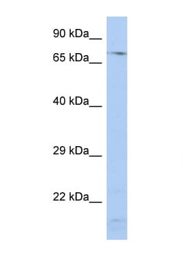 SRP72 Antibody (aa539-588)