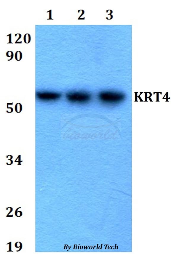 Polyclonal Rabbit anti-Human KRT4 / CK4 / Cytokeratin 4 Antibody (WB)