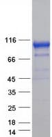 Human ECE-1 Protein (Recombinant Myc-DDK (Flag))