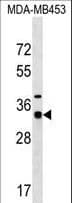 Polyclonal Rabbit anti-Human MYOZ2 / CS-1 Antibody (aa43-71, WB)