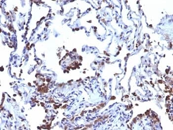 CD63 Antibody (clone NKI/C3 + LAMP3/968)
