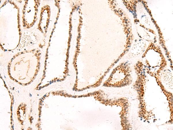 Polyclonal Rabbit anti-Human DCAF10 Antibody (IHC)