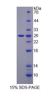 Human GHBP / BLVRB Protein (Recombinant His-S)