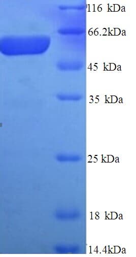 Rat GPC3 / Glypican 3 Protein (Recombinant His)