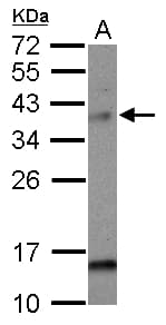 CMT2 / MAD2L1BP Antibody