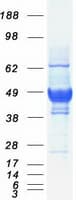 Human Basigin / Emmprin / CD147 Protein (Recombinant Myc-DDK (Flag))