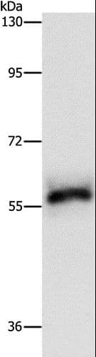 Polyclonal Rabbit anti-Human HCK Antibody (WB)