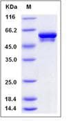 Human Vimentin Protein (Recombinant His,C-terminus)