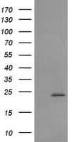 RAB30 Antibody (clone OTI1B2)