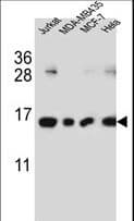 H2AFJ Antibody (aa1-30)