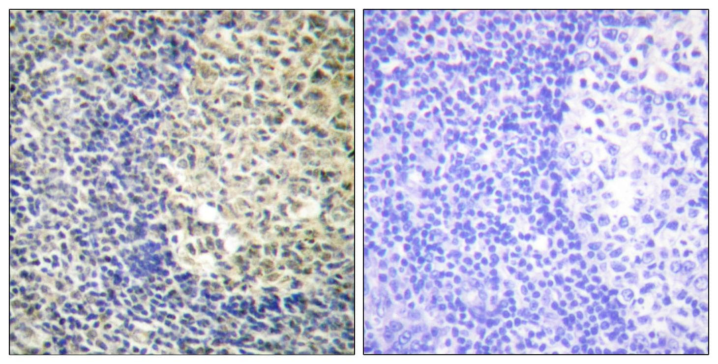 NCF1 / p47phox / p47 phox Antibody (phospho-Ser370)