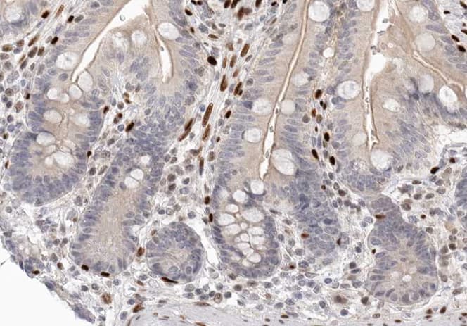 CDK2AP2 Antibody