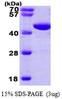 Human PGK1 / Phosphoglycerate Kinase Protein (Recombinant His)