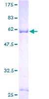 Human CSGALNACT1 Protein (Recombinant GST)