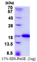 Human IFT20 Protein (Recombinant His)