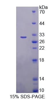 Human TICAM1 / TRIF Protein (Recombinant His-T7)