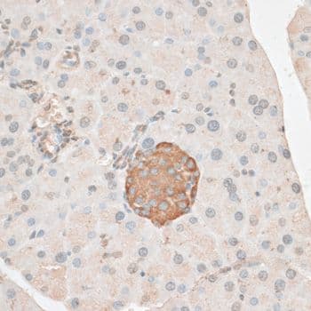 Polyclonal Rabbit anti-Human PDP2 Antibody (IHC, WB)