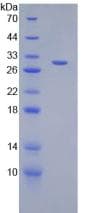 Mouse DGKA Protein (Recombinant His-T7)