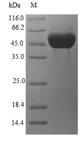 Escherichia coli ghrA Protein (Recombinant 6His-SUMO, N-terminus)