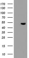 TDO2 Antibody (clone OTI2A4)