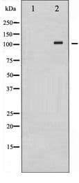 Polyclonal Rabbit anti-Human RB1 / Retinoblastoma / RB Antibody (IHC, WB)