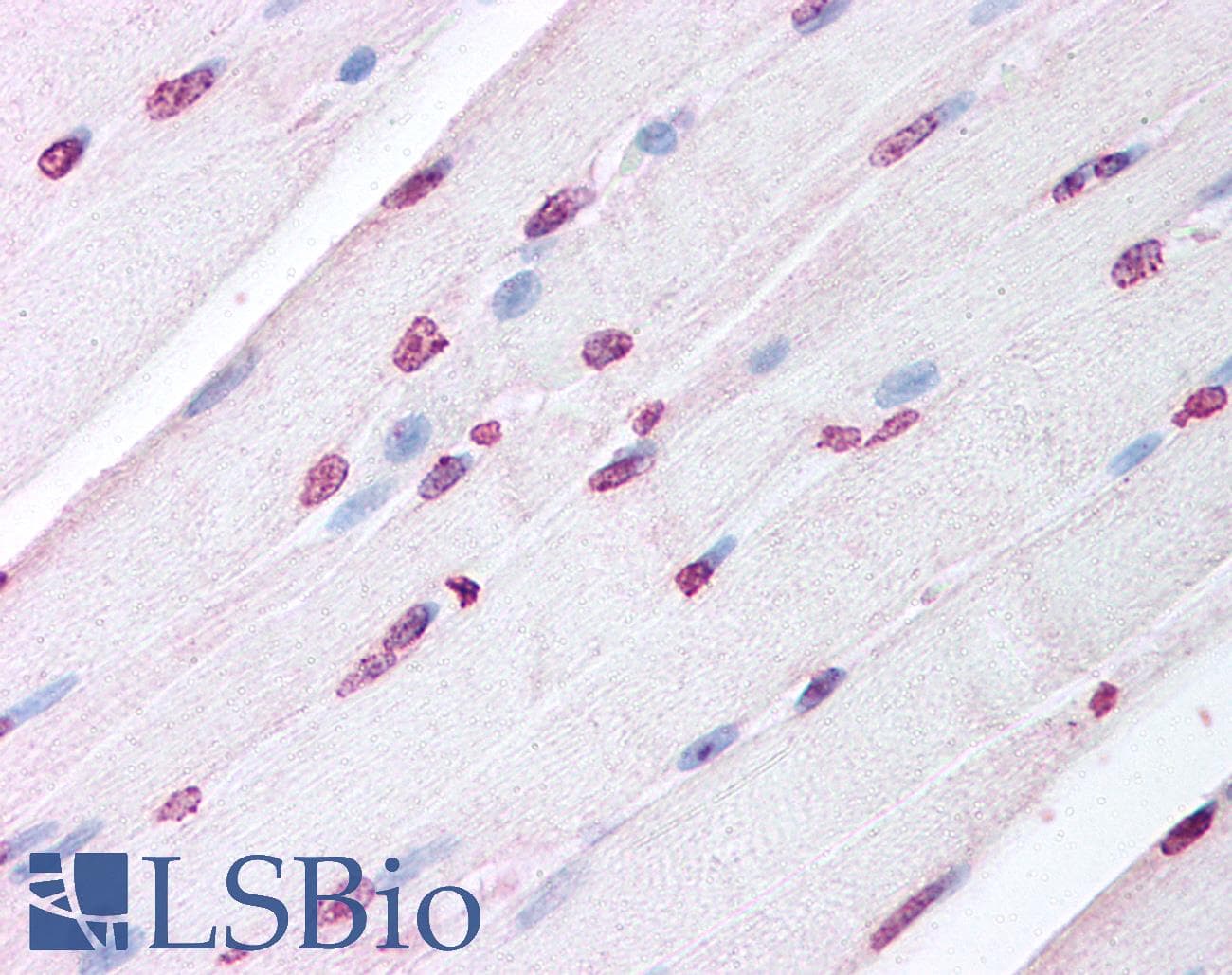IHC-plus™ LXR Alpha+Beta Antibody (aa50-150)