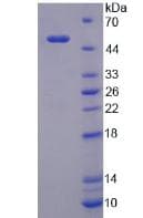 Human LBP Protein (Recombinant His, N-Terminal)