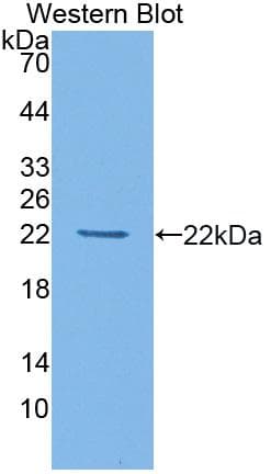 HDAC4 Antibody (aa904-1076, Biotin)