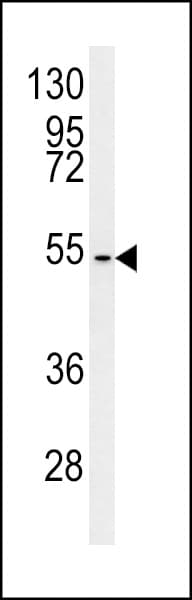 CCZ1 / CGI-43 Antibody (aa239-265)