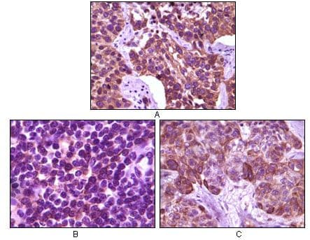 Monoclonal Mouse anti-Human BLK Antibody (clone 9D10B7H6, 9D10A8F8, IHC, WB)