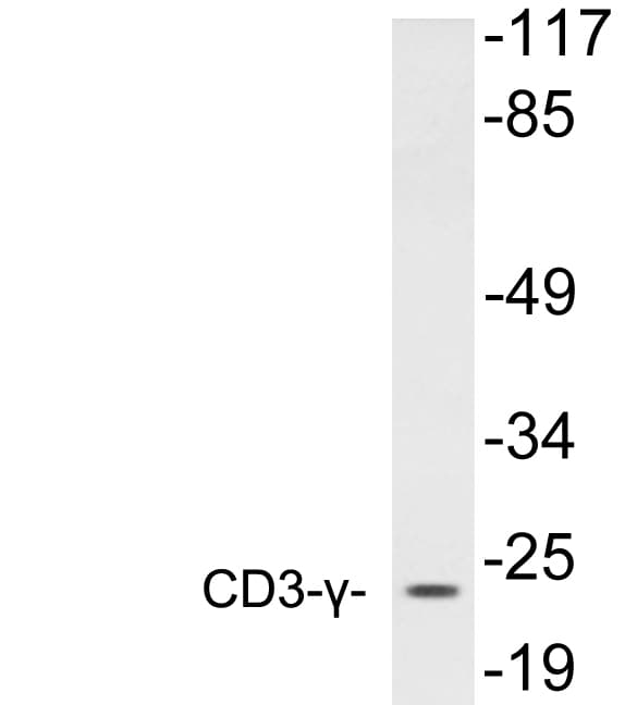 CD3G Antibody (aa90-139)