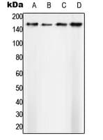 Polyclonal Rabbit anti-Human SF3B1 Antibody (N-Terminus, WB)