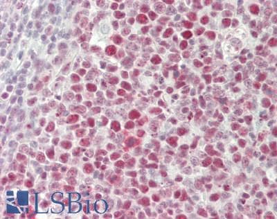 Polyclonal Rabbit anti-Human NCL / Nucleolin Antibody (aa388-569, IHC, WB)
