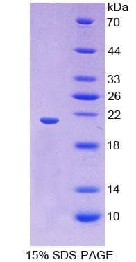 Human HMMR / CD168 / RHAMM Protein (Recombinant His-T7)