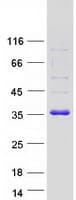 Human CBR / CBR1 Protein (Recombinant Myc-DDK (Flag))