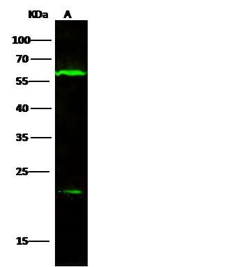 Polyclonal Rabbit anti-Pig IL-10 Antibody (Preservative Free, WB)
