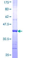 Human GCN2 Protein (Recombinant GST, N-terminus)