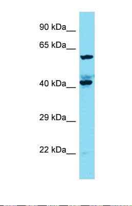 KIAA1841 Antibody (aa493-541)