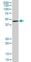 Monoclonal Mouse anti-Human BLMH Antibody (clone 4A2, WB)
