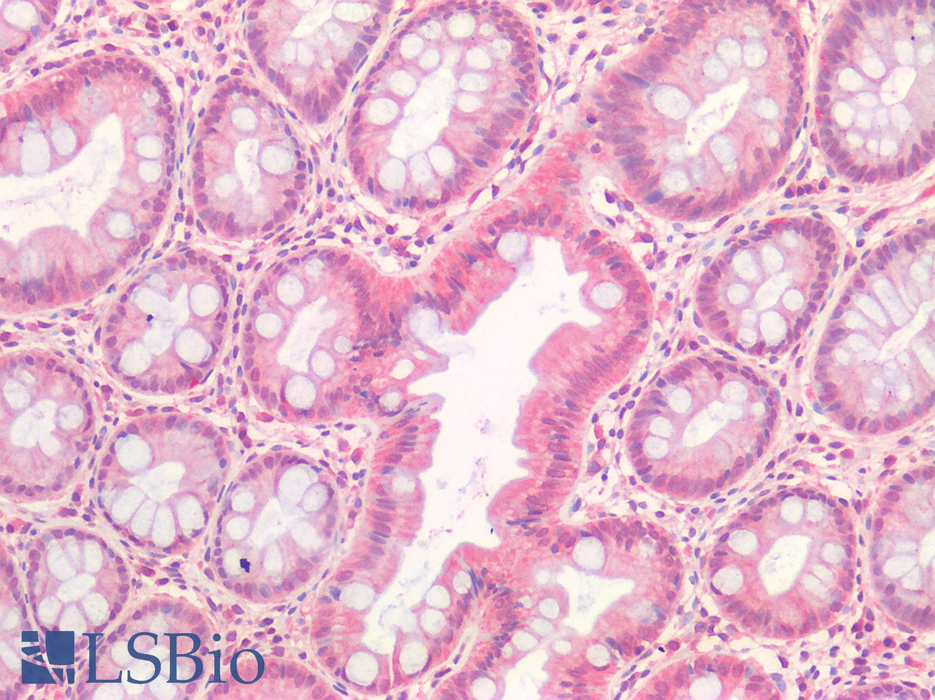 IHC-plus™ HGF / Hepatocyte Growth Factor Antibody