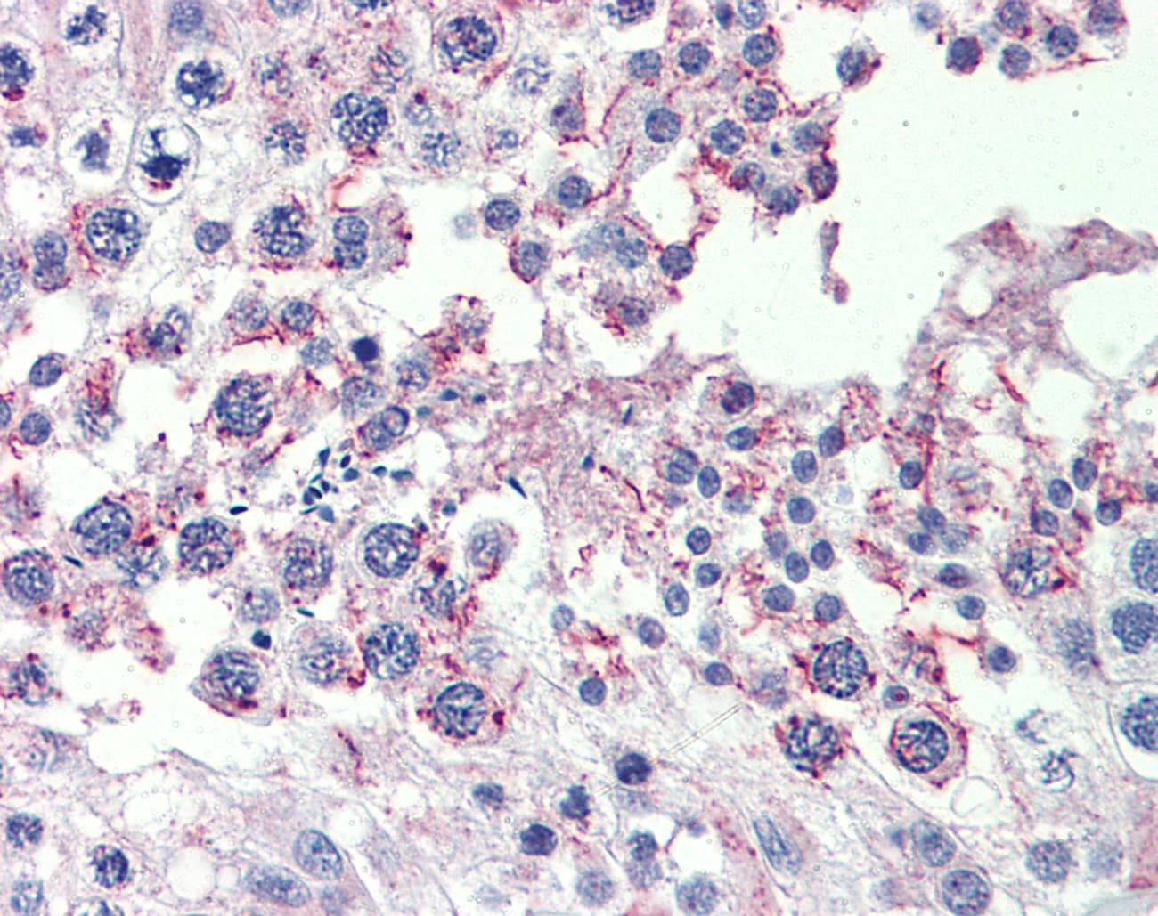 Polyclonal Rabbit anti-Human CPXCR1 / CT77 Antibody (aa396-445, IHC, WB)