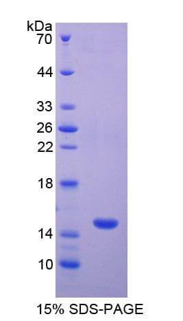 Mouse GFAP Protein (Recombinant His, N-Terminal)