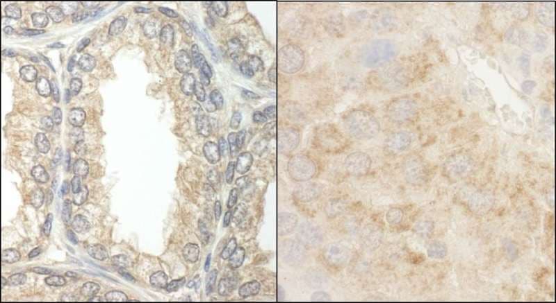 Polyclonal Rabbit anti-Human BAD Antibody (aa1-50, IHC)