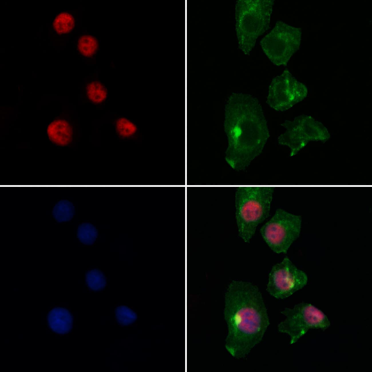 Polyclonal Rabbit anti-Human EGLN3 / PHD3 Antibody (IF, WB)