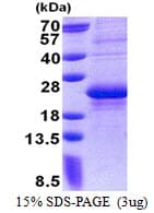 Human CD7 Protein (Recombinant His)