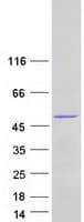 Human PRMT6 Protein (Recombinant Myc-DDK (Flag))